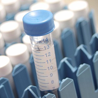 E' italiano il virus-killer che uccide i tumori.