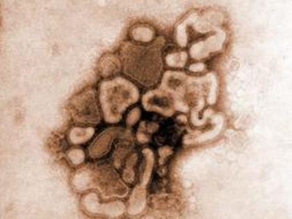 Virus influenza suina.